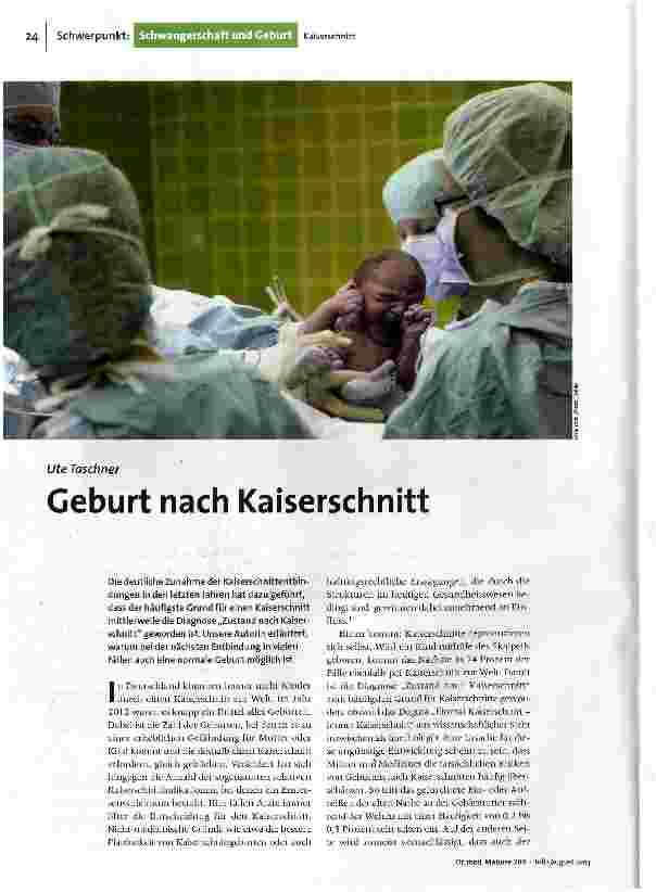 [doc_143818] Geburt nach Kaiserschnitt